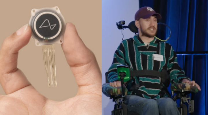 Neuralink's First Patient Names His Brain Implant and Uses It to Learn French and Japanese 1 Screenshot 20240830 1254332