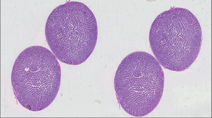 AI Revolutionizes Disease Detection: A Leap Forward in Medical Diagnostics 1 Screenshot 20241118 2118372