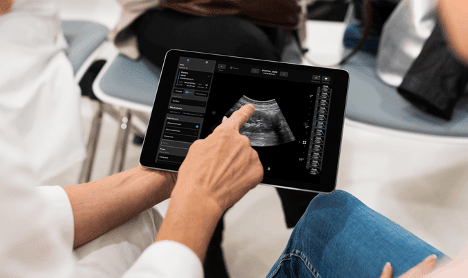 Samsung Eyes $100M Investment in AI Ultrasound Startup Exo 1 blogger image Jh8dH2DwmX